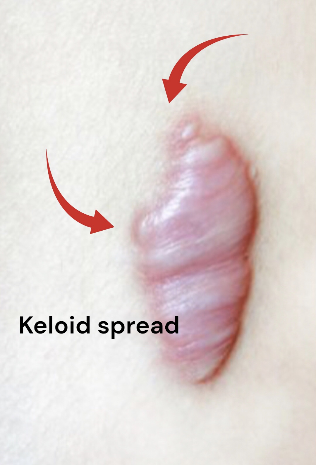 Natural Scar Care: Hei Ba Gao Keloid Treatment Masque 120ml - Image 4